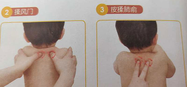 小儿推拿推拿处方感冒